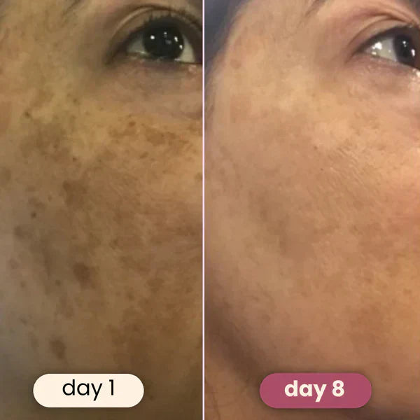 🧴Turmeric Sérum® - Corretor de Manchas Escuras🧪