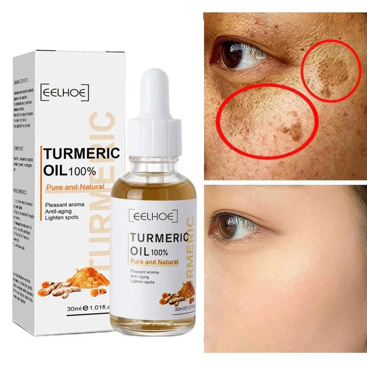 🧴Turmeric Sérum® - Corretor de Manchas Escuras🧪
